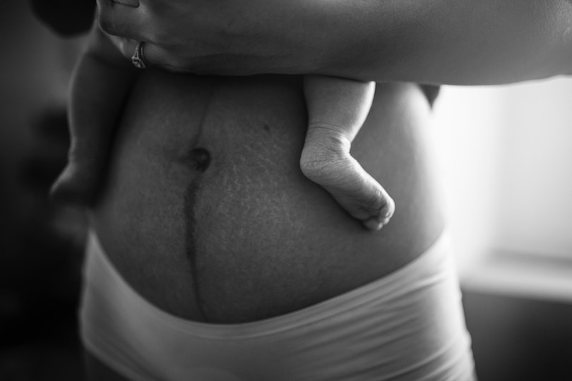 Corps et post-partum : comment se rétablir après un accouchement ?