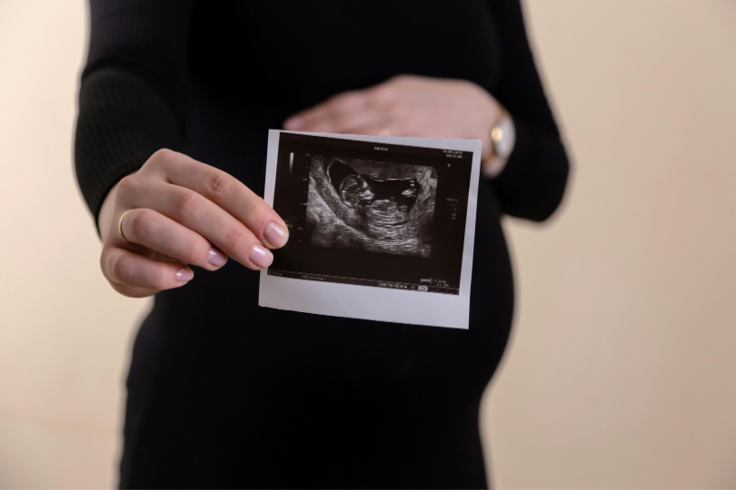 Première échographie de grossesse : déroulement, date et conseils d’experts